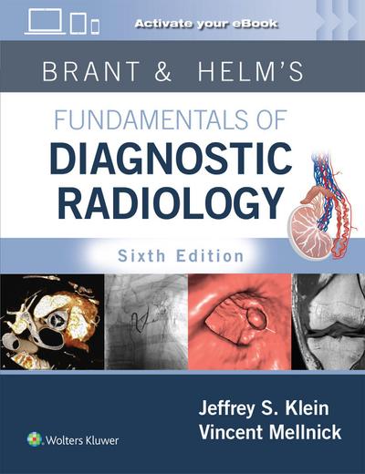 Brant & Helms’ Fundamentals of Diagnostic Radiology: Print + eBook with Multimedia