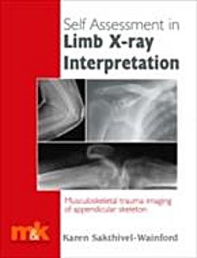 Self-assessment in Limb X-ray Interpretation