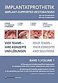 Implantatprothetik. Blu-Ray, Band 1