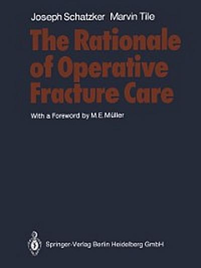 Rationale of Operative Fracture Care