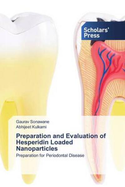 Preparation and Evaluation of Hesperidin Loaded Nanoparticles
