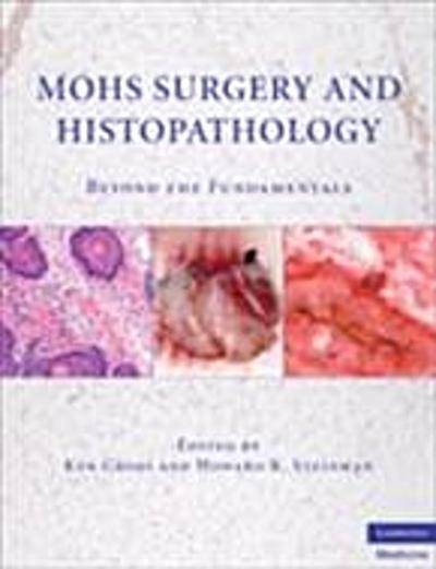 Mohs Surgery and Histopathology