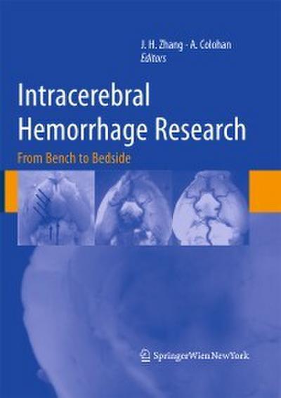Intracerebral Hemorrhage Research