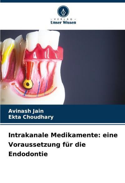 Intrakanale Medikamente: eine Voraussetzung für die Endodontie