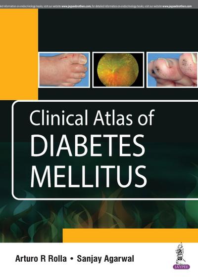 Clinical Atlas of Diabetes Mellitus