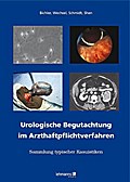 Urologische Begutachtung im Arzthaftpflichtverfahren
