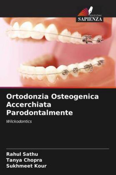 Ortodonzia Osteogenica Accerchiata Parodontalmente