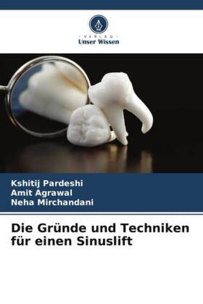 Die Gründe und Techniken für einen Sinuslift