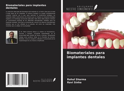 Biomateriales para implantes dentales