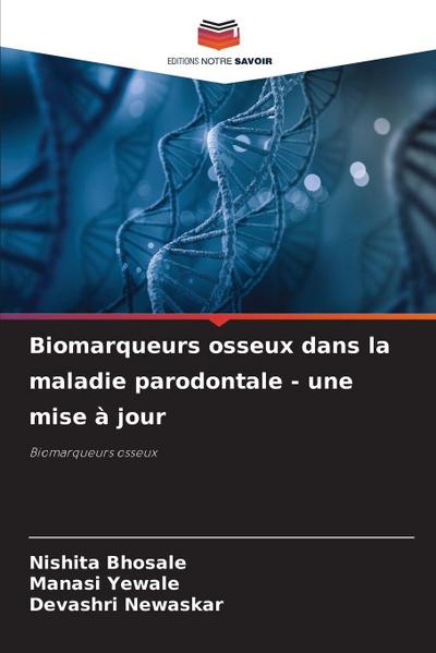 Biomarqueurs osseux dans la maladie parodontale - une mise à jour