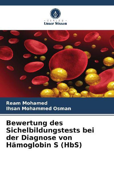 Bewertung des Sichelbildungstests bei der Diagnose von Hämoglobin S (HbS)