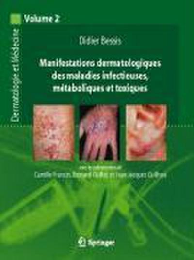 Manifestations dermatologiques des maladies infectieuses, métaboliques et toxiques