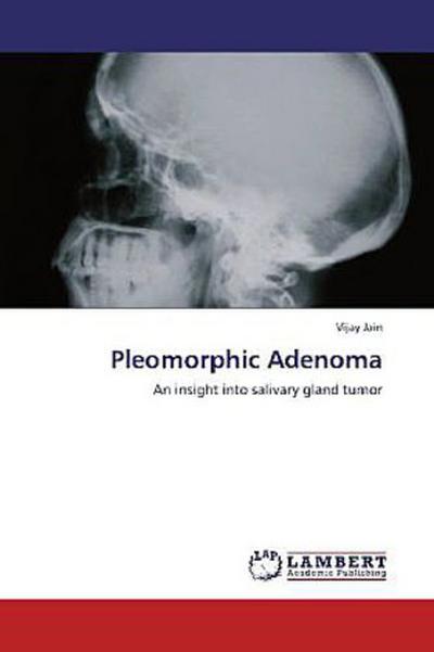 Pleomorphic Adenoma
