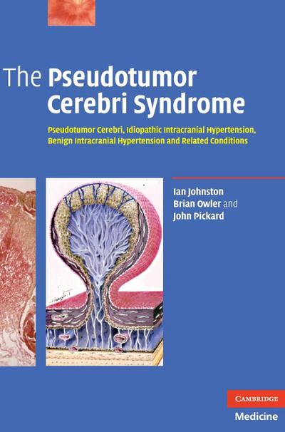 The Pseudotumor Cerebri Syndrome