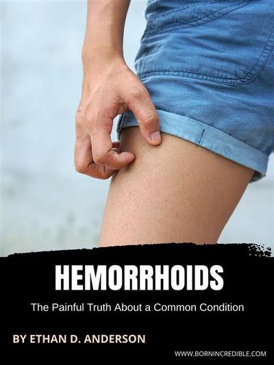Hemorrhoids