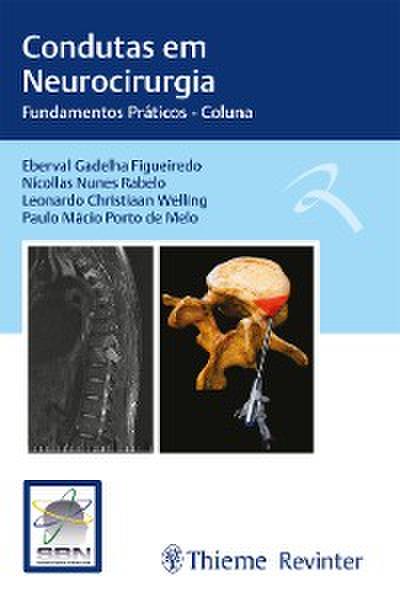 Condutas em Neurocirurgia