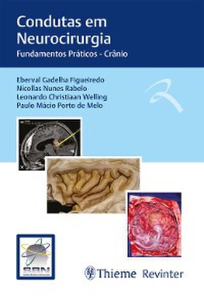 Condutas em Neurocirurgia