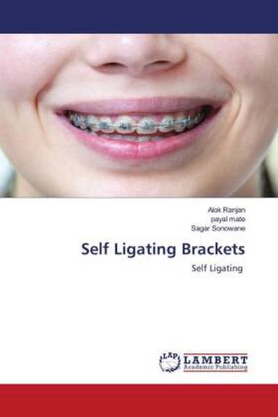 Self Ligating Brackets