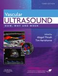Vascular Ultrasound