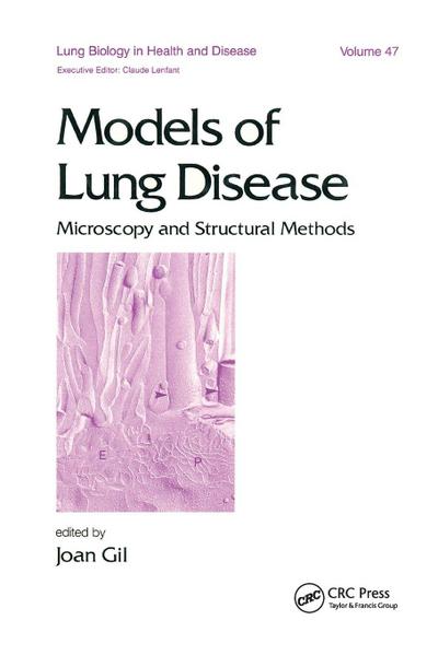 Models of Lung Disease