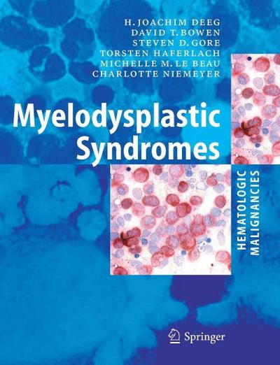 Myelodysplastic Syndromes