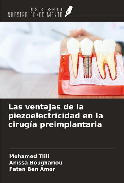 Las ventajas de la piezoelectricidad en la cirugía preimplantaria