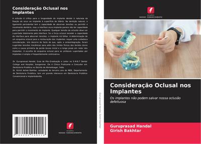 Consideração Oclusal nos Implantes