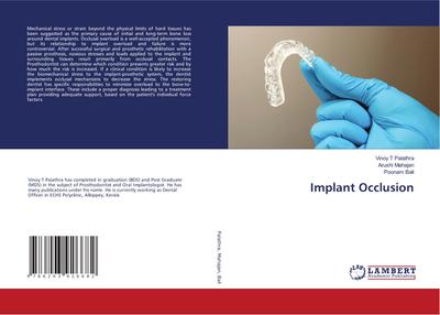 Implant Occlusion