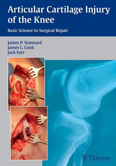 Articular Cartilage Injury of the Knee: Basic Science to Surgical Repair