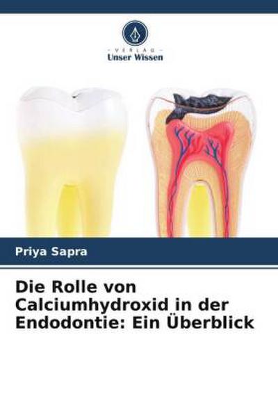 Die Rolle von Calciumhydroxid in der Endodontie: Ein Überblick