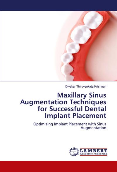 Maxillary Sinus Augmentation Techniques for Successful Dental Implant Placement