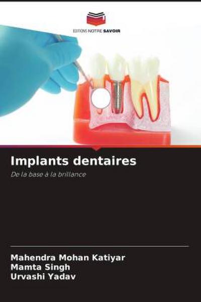 Implants dentaires