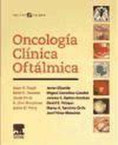 Oncología clínica oftálmica