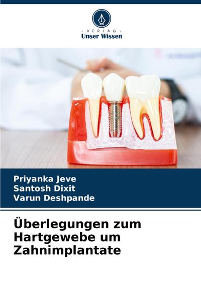 Überlegungen zum Hartgewebe um Zahnimplantate