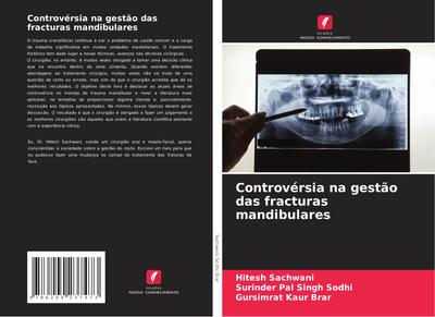 Controvérsia na gestão das fracturas mandibulares