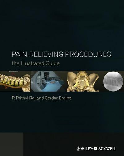 Pain-Relieving Procedures