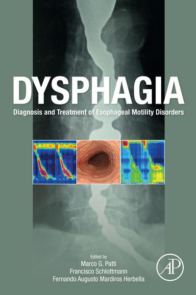 Dysphagia