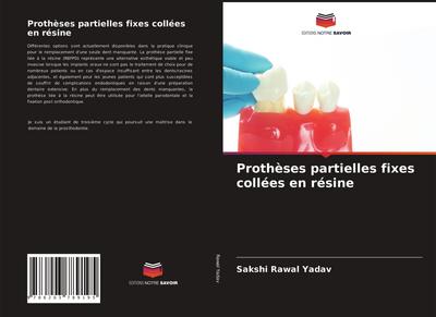 Prothèses partielles fixes collées en résine