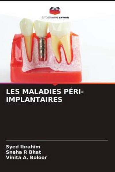 LES MALADIES PÉRI-IMPLANTAIRES