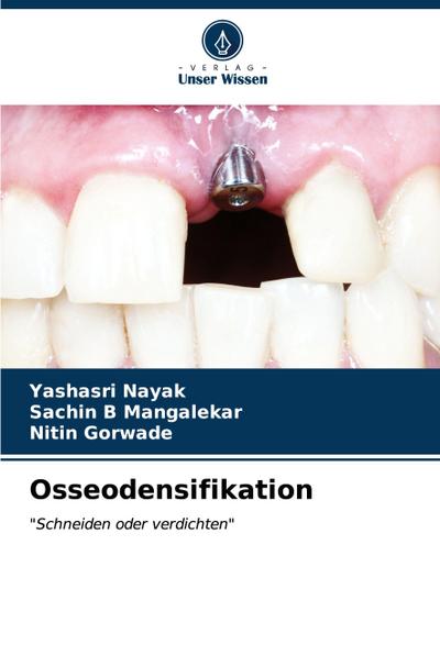 Osseodensifikation