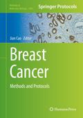 Breast Cancer