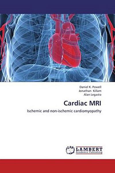 Cardiac MRI
