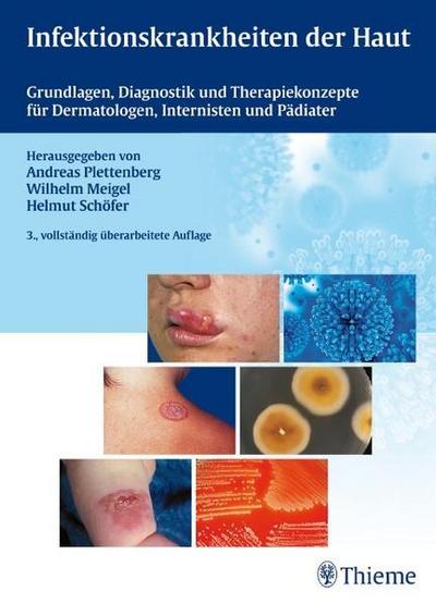 Infektionskrankheiten der Haut: Grundlagen, Diagnostik, Therapiekonzepte f. Dermatologen, Internisten u Pädiater: Grundlagen, Diagnostik und Therapiekonzepte für Dermatologen, Internisten und Pädiater