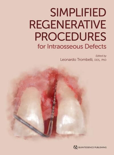 Simplified Regenerative Procedures for Intraosseous Defects (eBook, PDF) - Leonardo Trombelli