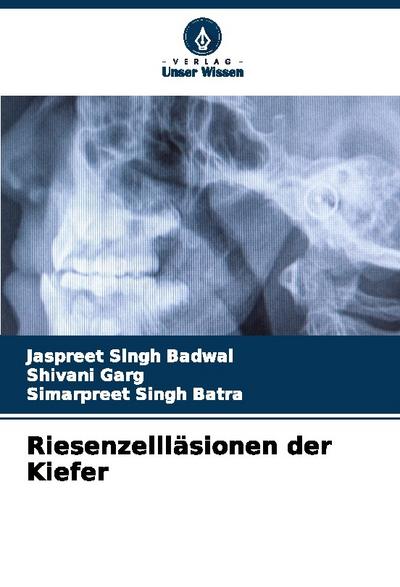 Riesenzellläsionen der Kiefer