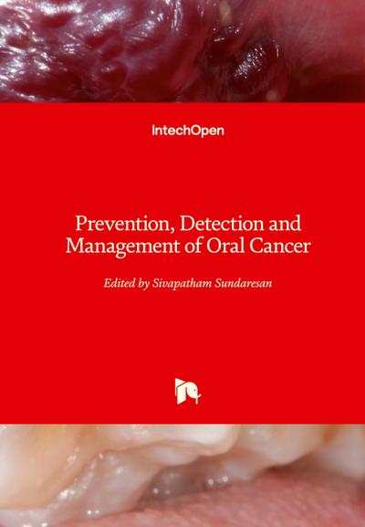 Prevention, Detection and Management of Oral Cancer