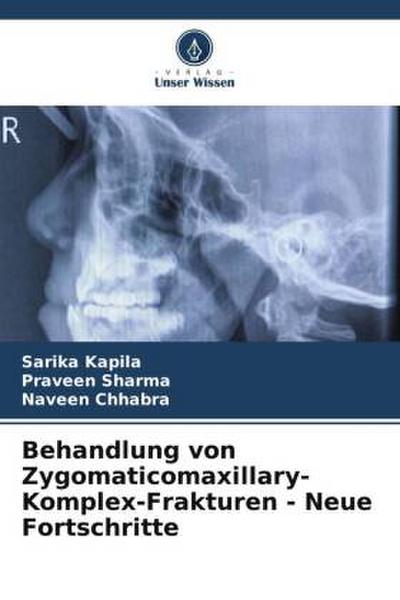 Behandlung von Zygomaticomaxillary-Komplex-Frakturen - Neue Fortschritte