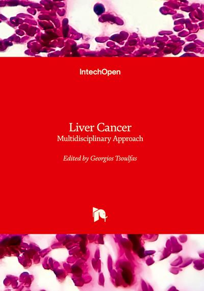 Liver Cancer - Multidisciplinary Approach