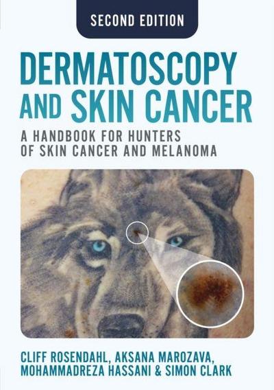 Dermatoscopy and Skin Cancer, second edition