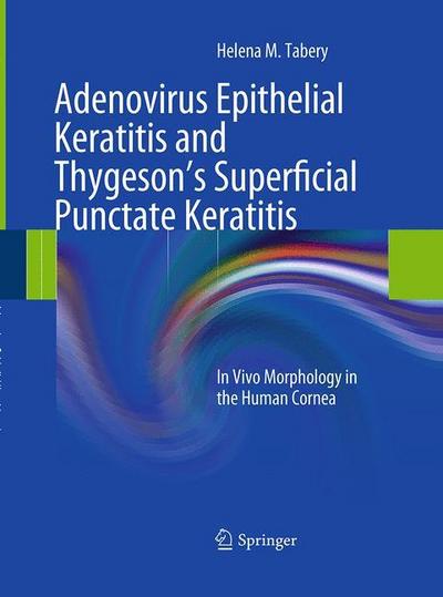Adenovirus Epithelial Keratitis and Thygeson’s Superficial Punctate Keratitis